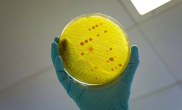 Antimicrobial resistance displayed in a clear ball. Photo by DFID - UK Department for International Development. Wikimedia.