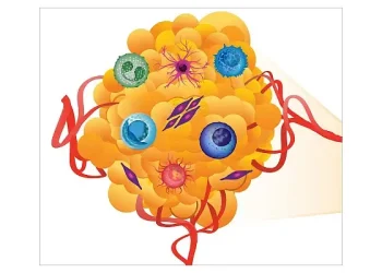 The Human Tumor Atlas Network seeks to understand the molecular features of tumors and their microenvironments. Photo by National Care Institute.