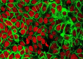 Human Colon Cancer Cells. Photo by National Institutes of Health.