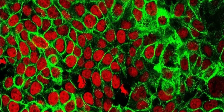 Human Colon Cancer Cells. Photo by National Institutes of Health.