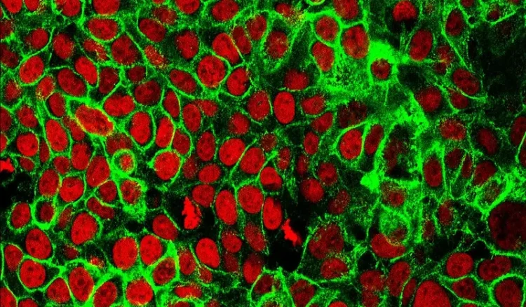 Human Colon Cancer Cells. Photo by National Institutes of Health.