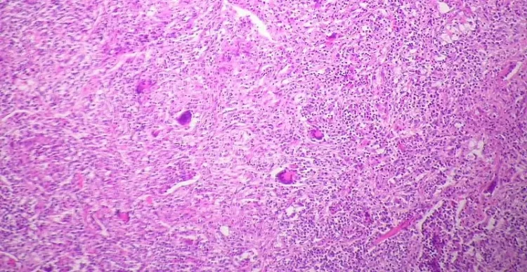 Bovine tuberculosis. Photo by Laboratorio Diagnostica Ancona.