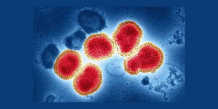 Colorized transmission electron micrograph of influenza A virus particles, colorized red and gold, isolated from a patient sample and then propagated in cell culture. Photo by NIAID.