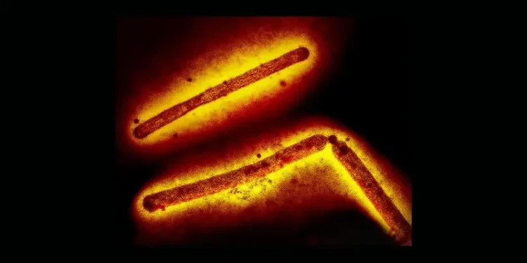Three influenza A H5N1 bird flu virus particles. Photo by the CDC and NIAID