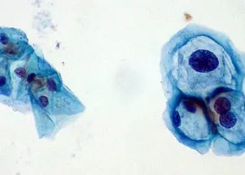 HPV On Pap Smear. Photo by Ed Ethman.