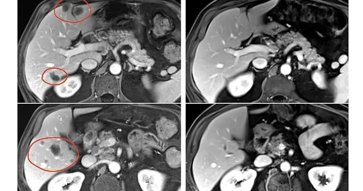 Image of gastrointestinal cancers. Photos by the NIH.