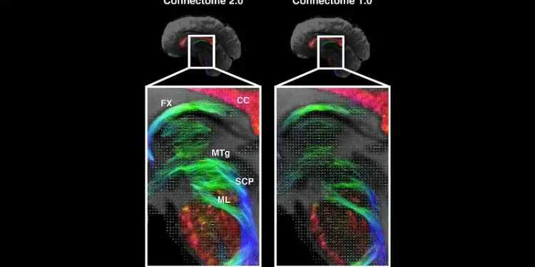MRI Images. Photo by the NIH