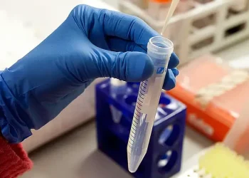 Test tube. Photo by Vall d'Hebron Research Institute.