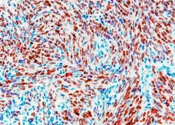 Imaging and histochemistry by Anthony B. Eason, lab of Dirk Dittmer, University of North Carolina Lineberger Comprehensive Cancer Center.