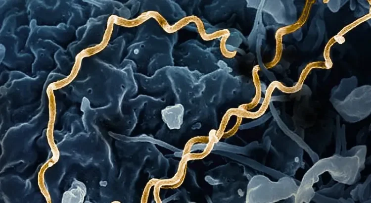 Treponema pallidum Bacteria - Syphilis. Photo by NIAID.