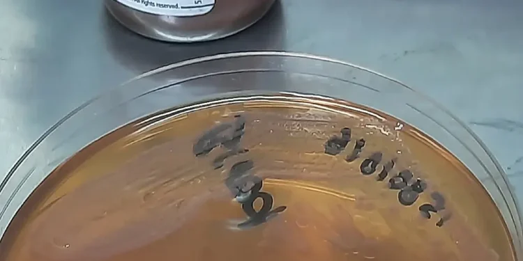 Bloodstream Infection by Serratia marcescens in a Neonate- Culture Growth in Broth and Agar Media. Photo by Ajay Kumar Chaurasiya.