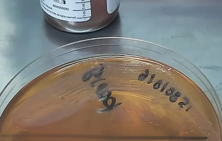 Bloodstream Infection by Serratia marcescens in a Neonate- Culture Growth in Broth and Agar Media. Photo by Ajay Kumar Chaurasiya.
